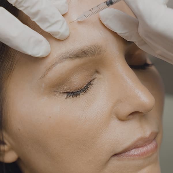 botox-forehead